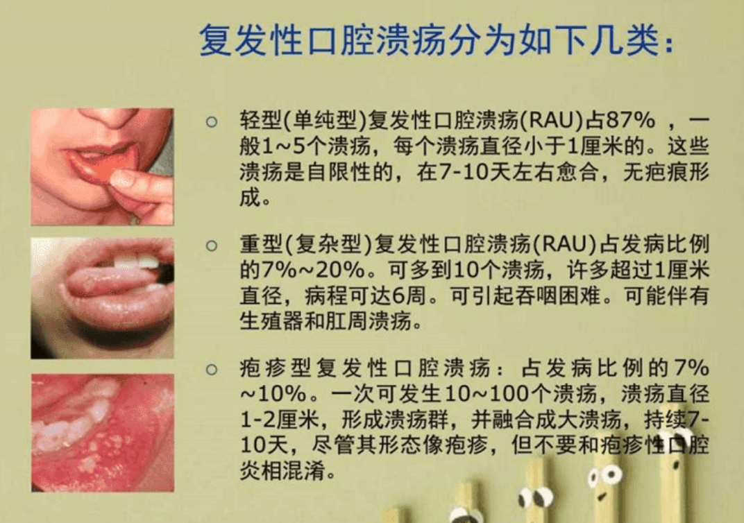 每个月溃疡,每个月溃疡，成因、症状与防治策略