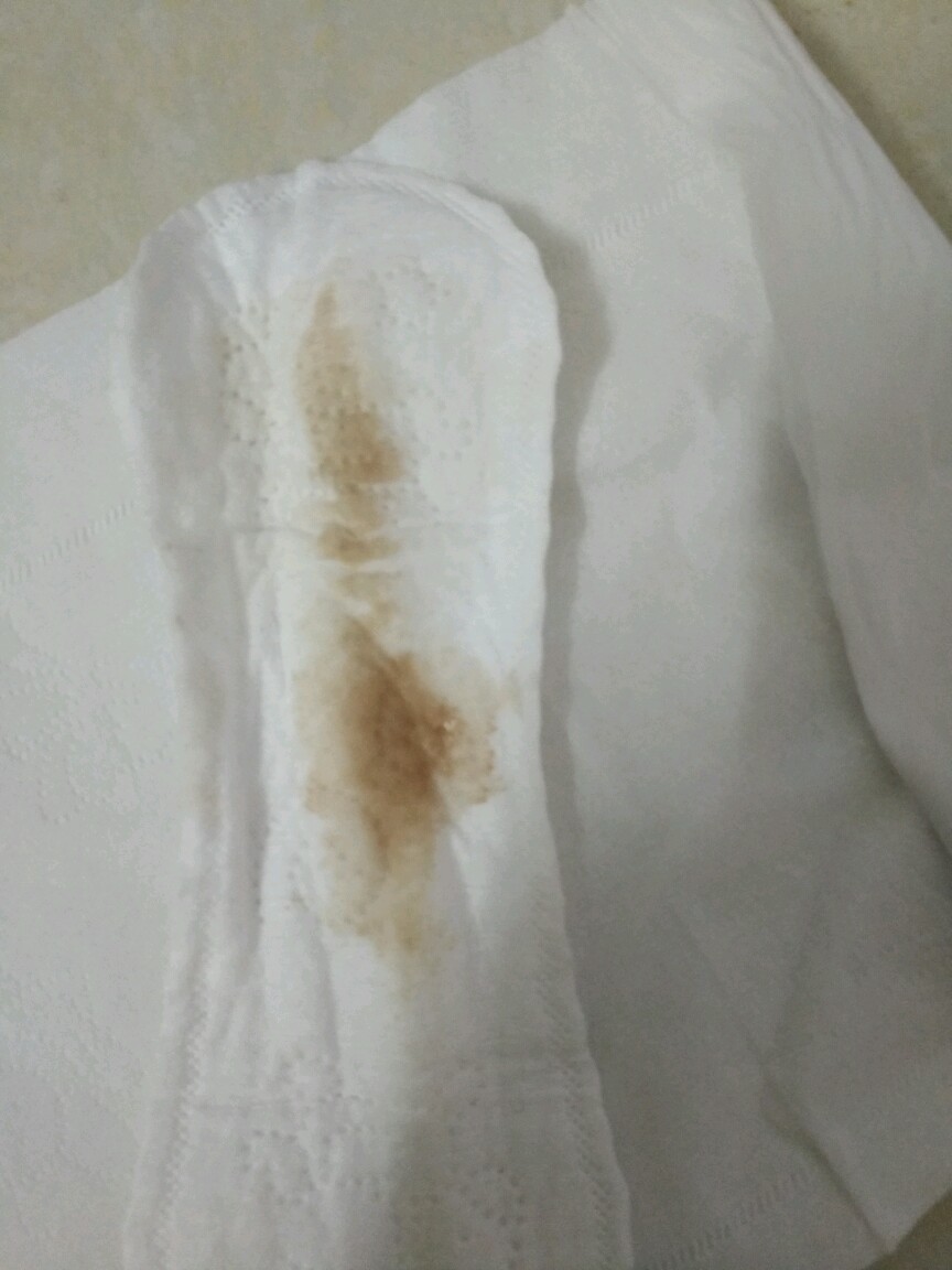 褐色分泌物半个月了,关于褐色分泌物的持续现象，了解、分析与应对